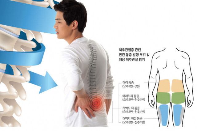 서울 척추전문병원 추천 4곳(2025)|청담, 강남, 성북 비교 후기까지 4 image 18 22